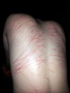 Nothing major. Just some claw marks.