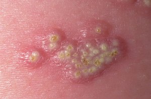 ???????????????????????????????????????????????????????????????